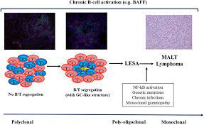 Frontiers Lymphoma And Lymphomagenesis In Primary Sjogren S Syndrome Medicine