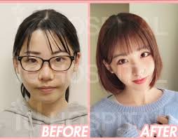 Japanese Model Azusa Had Plastic Surgery In Id Hospital