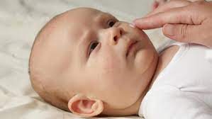Perubahan cuaca, cuaca yang ekstrim, debu dan udara yang lembab merupakan faktor luar yang paling dominan mempengaruhi kulit bayi. 9 Bintik Merah Pada Bayi Begini Cara Mengatasinya Bun