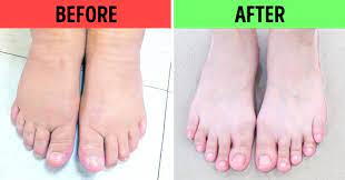 A simple soak with them in the tub may help you feel better. 10 Types Of Foot Baths And Which Health Problems They Can Solve