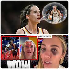 LEXIE HULL LEFT CHICAGO SHAKEN.” No Caitlin Clark. No safety net. And no  hiding from the pain. Lexie Hull, taped up and limping, still threw herself  into the fight, turning every ounce