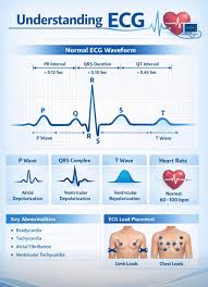 Image result for Electrocardiogram Validity