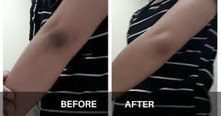 Houseofbeautyworld.com has been visited by 10k+ users in the past month 6 Natural Home Remedies For Dark Knees And Elbows