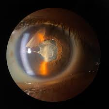 Image result for Pavetta cataractarum