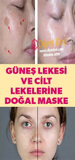 Gunes Lekesi Ve Cilt Lekelerine Dogal Maske Ile Son Verin Skin Blemishes Natural Mask Skin