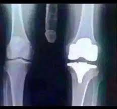 My Knee Xray Boy Its Sore Radiology Humor X Ray Xray Humor