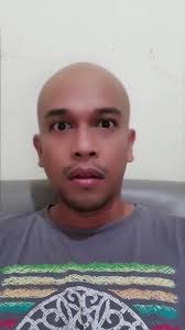 Bangun-bangun rambut sudah botak aja kayak Bro @theo.surbakti...