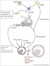 Image result for Anovulation