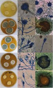 Viewing the fungi under a microscope, micheli was reminded of the shape of an aspergillum (holy water sprinkler), from latin spargere (to sprinkle), and named the genus accordingly. Morphological Features Of Aspergillus Penicillium And Talaromyces Download Scientific Diagram
