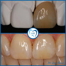 Anchor Road Dental Practice Dentist Dental Office Walsall Facebook 53 Photos