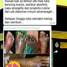 Selain itu, petua ini berkesan bagi mengubati kencing manis secara menyeluruh dengan cara yang lebih kurang dengan kaedah mengawal paras gula. Sembuhkan Luka Kencing Manis Elak Kaki Dipotong Ohcantik Com