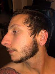 Repeat until all facial hair has been removed. 24 Beard Still Not Connected Will It Ever Connect Beard Board
