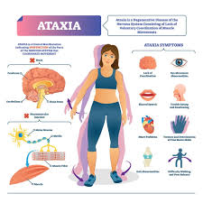 Image result for Ataxia