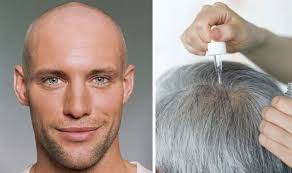 Some hair loss is normal, but sudden or accelerating hair loss—a prevalent concern for men and women alike—can signal an underlying health issue. Hair Loss Treatment 90p Vegetable Juice To Avoid Alopecia Symptoms Express Co Uk