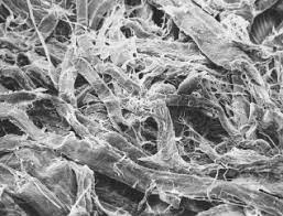 Maybe you would like to learn more about one of these? Toilet Paper As Seen Under A Scanning Electron Microscope Tesis