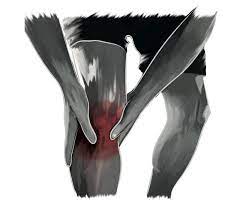 The massage thus reduces painful symptoms in the joints and skeletal muscle. Cetilar Cetilar Massage Coadiuvant Pharmanutra