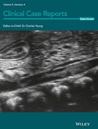 Nauman khalid sarah aftab ahmad lovely chhabra. Clinical Case Reports Vol 9 No 4