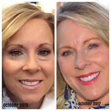 Beauty is in the eye of the beholder.