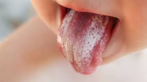 Get a wet cloth and gently wipe your baby's tongue. 7 Best And Easy Ways To Clean Your Baby Tongue