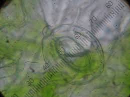 Image result for Stomatostemma