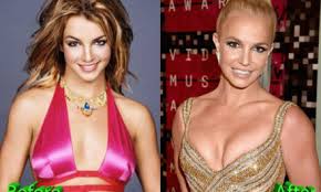 To use natural methods of rejuvenation you can also combine both methods. Nancy O Dell Joins The List Of Plastic Surgery Stars