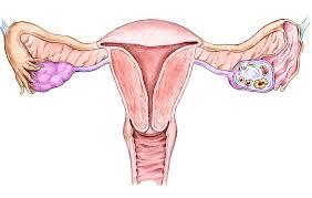 There are many signs of endometrial cancer a woman might experience. 5 Warning Signs Of Endometrial Cancer Every Woman Should Know Prevention
