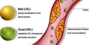 6 Ways To Reduce Cholesterol Level In Your Body - Life In Saudi Arabia