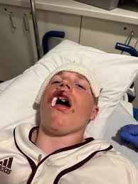 Tucker Timmerman took a 106 mph baseball to the face and walked off the  field 🤯(via NateClouse/X)