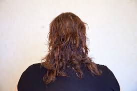 Home remedies to get rid of scalp pimples. How To Cleanse Sebum Plugs From The Scalp