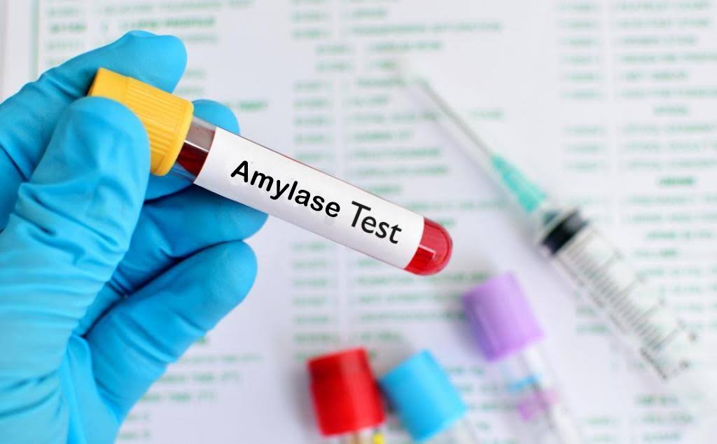 AMYLASE product image