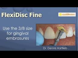 Strips covered with submicron diamond particles. Finishing And Polishing Composite Restorations Youtube