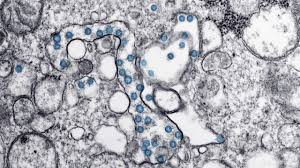 As Covid 19 Cases Spike Some Forming Support Bubbles To Socialize Safely