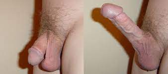 Erect Penis - XXGASM