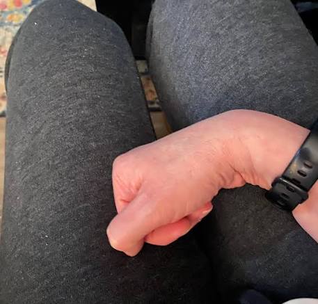 Why do I position my hand like this??? I got picked on when I was younger  by the other girls because of this. Now I'm wanting to see everyone else's  hand placement