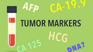 Tumor marker was slightly high at 45 (40 is the high end of normal). Tumor Marker Tests Cancerconnect