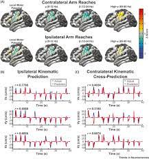 Continue scrolling or click here The Cortical Physiology Of Ipsilateral Limb Movements Trends In Neurosciences