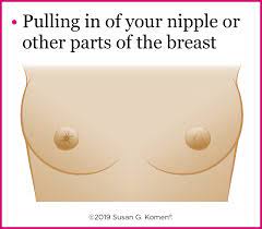As the cancer progresses, signs and the information on this site should not be used as a substitute for professional medical care or advice. Warning Signs Of Breast Cancer Do You Know What To Watch For