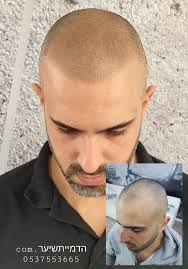 אדם בתוך עצמו הוא גר אנשים מתכננים שנים את בית החלומות שלהם, לוקחים משכנתא ומהנדס.אבל לבנות את היסודות שמחזיקים את הבית שנקרא ״אני״ שוכחים לעיתים קרובות מידי. 2