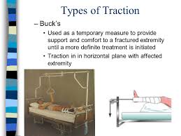 Distal radius fractures programme online course: Nursing Of Adults With Medical Surgical Conditions Ppt Video Online Download