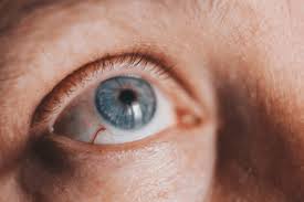 Keratitis may or may not be associated with an infection. Keratitis Symptoms Causes Diagnosis Treatment And Prevention Factdr