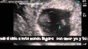 Aqui Estoy Cancion Para Un Bb Que Viene En Camino Youtube
