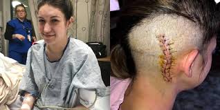 But there are many ways you can help. What Are The Symptoms Of A Brain Tumor Vertigo Signaled Trouble For Bride