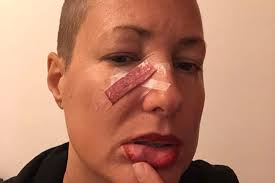 Fundraiser for STAR ROTH by Marco Misfailed Mancia : Star's tragic accident  abroad