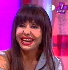 A misteriosa baixa da pivot do Jornal de Sexta