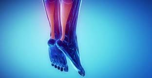 Durée, symptômes, diagnostic alexandre auffret, kinésithérapeute et ostéopathe du sport; Tendinopatia Del Tendine D Achille Diagnosi E Cura Studio Radiologico Pansini