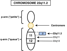 Digeorge 22q11 2 Deletion Syndrome Psychdb