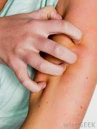What Are The Signs Of A Clindamycin Allergy With Pictures