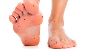 Jangan lupa tinggalkan komen, like. Tanda Tanda Orang Terkena Gejala Awal Diabetes Sering Kesemutan Selalu Lapar Hingga Haus Bangka Pos