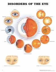 Laminated Chart Disorders Of The Eye