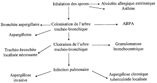 Aspergillosis is a fungal infection of usually the lungs, caused by the genus aspergillus, a common mold that is breathed in frequently from the air around, but does not usually affect most people. Physiopathologie Des Aspergilloses Bronchopulmonaires Download Scientific Diagram